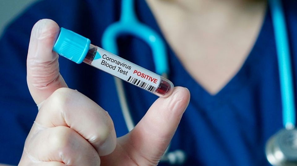 Corona Virus Pic
