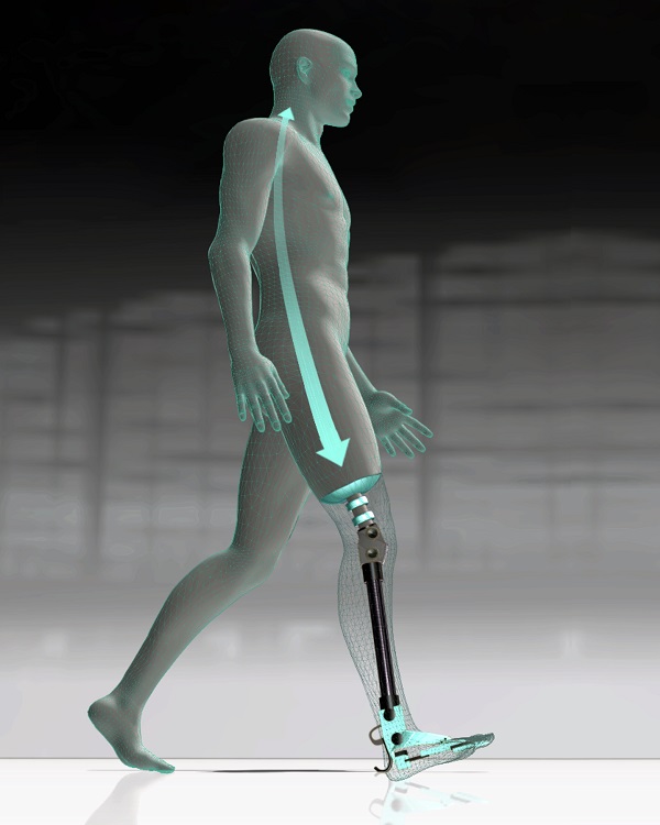 Prome Cirugia Di Osteointegracion Na Hospital Di Aruba...3